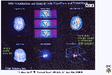 DvC1-01_SEG103